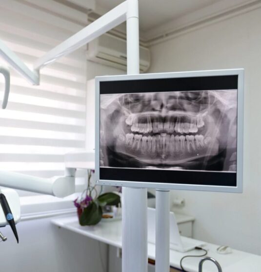 Patient receiving digital dental X-rays in Towson MD at Smithberger DDS